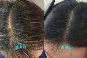 怎么让头发变白,怎么让头发变白最快的方法