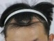 发际线为什么会变高（为啥明明头发很多为什么发际线还那么高）