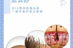 头皮油多怎么办（头皮油多怎么办小妙招）