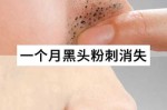 毛孔粗有黑头怎么办（毛孔粗有黑头怎么办用什么才好）
