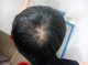 为什么头顶头发稀少（为什么头顶头发稀少）