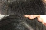 头皮屑多是什么发质（头皮屑多是什么发质的原因）