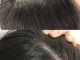 头皮屑多是什么发质（头皮屑多是什么发质的原因）