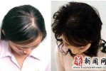 老掉头发是怎么回事,经常脱头发怎么办女性