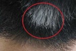 头发两侧白发是什么原因,头发两边白是什么原因引起的,怎样调理