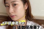 下颚大怎么办（为什么女孩子下颌角大）