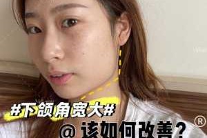 下颚大怎么办（为什么女孩子下颌角大）