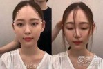 额头高留什么发型（发际线高怎么扎头发才好看）