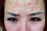 染发过敏该怎么办（染发过敏该怎么办小妙招）