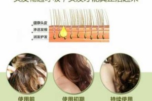 怎么滋养头发（怎么滋养头发毛囊）