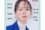 怎么快速除痘（脸上长痘怎么办才能快速消除）