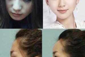 怎么样的额头不好看（什么样子的额头好看）