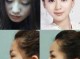 怎么样的额头不好看（什么样子的额头好看）