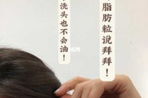 头皮很油怎么调理（头皮很油怎么调理好）