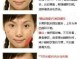 下巴容易长痘痘怎么办（下巴长痘痘如何消除）