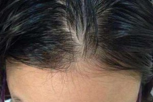 头发油是什么原因,女人头发爱出油怎么回事