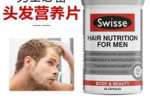 落发吃什么好（落发吃什么可以补救）