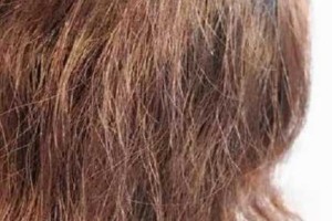 发质差怎么改善（发质差怎么改善男）