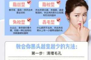黑头怎么清理（毳毛型黑头怎么清理）