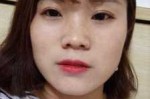 塌鼻梁是什么样子,什么是塌鼻梁图片女