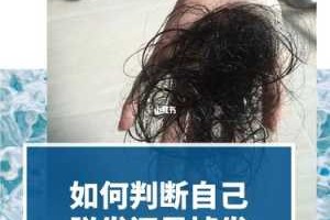 如何分辨人的头发是几度受损发质,怎么辨别脱发还是掉发
