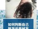 如何分辨人的头发是几度受损发质,怎么辨别脱发还是掉发