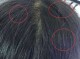头发白是什么原因引起的,头发变白是什么原因造成的