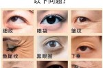 眼睛怎么去皱（眼去皱用什么）