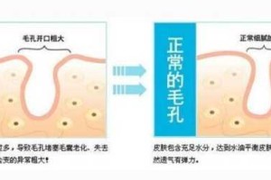 头发毛孔堵塞怎么彻底清理,脸上毛孔堵塞怎么疏通毛孔