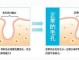 头发毛孔堵塞怎么彻底清理,脸上毛孔堵塞怎么疏通毛孔