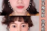 方脸的人怎么瘦脸（方脸怎么改善咬肌）