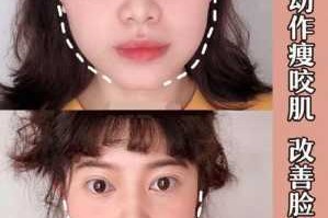 方脸的人怎么瘦脸（方脸怎么改善咬肌）
