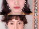 方脸的人怎么瘦脸（方脸怎么改善咬肌）