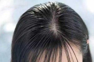 怎么算油性发质（怎么算油性发质,怎么算干性）