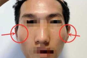 男生颧骨高代表什么（男生说自己黑怎么高情商回复）