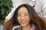 额头高怎么治（额头高怎么治疗）