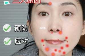 下巴起痘怎么办（下巴长痘痘怎么消除）