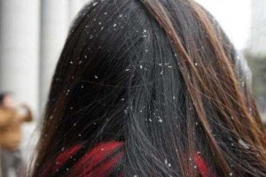 干性头屑太多怎么去除（干性头屑太多怎么去除小妙招）