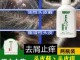 头皮痒有头屑用什么洗发水,什么去头皮屑头痒最好最有效