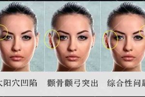 什么是脸宽（脸宽14cm算大脸吗）