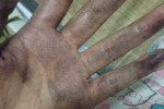 手染色了怎么洗掉（手上沾了染料去除妙招）