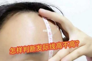 发际线高是什么样子（怎样判断发际线高）