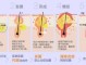 粉刺痤疮是怎么生成的（粉刺痤疮是怎么生成的）