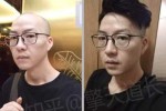 光头带什么假发好（剃光头戴假发怎么样）