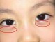 孩子的眼袋很大有点肿，是怎么回事呢,眼袋很大是怎么回事啊