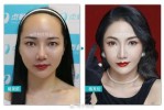 发际线高怎么形容,额头大怎么说好听