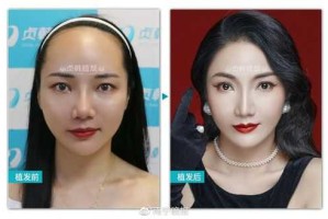 发际线高怎么形容,额头大怎么说好听