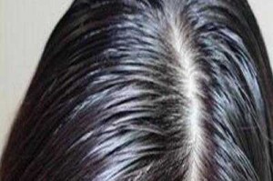 为什么头发被太阳晒会油,头发冒油是什么原因造成的