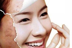脸堵塞怎么办图片（脸堵塞怎么办图片大全）