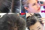 为什么有少白头（为什么有少白头的现象?）